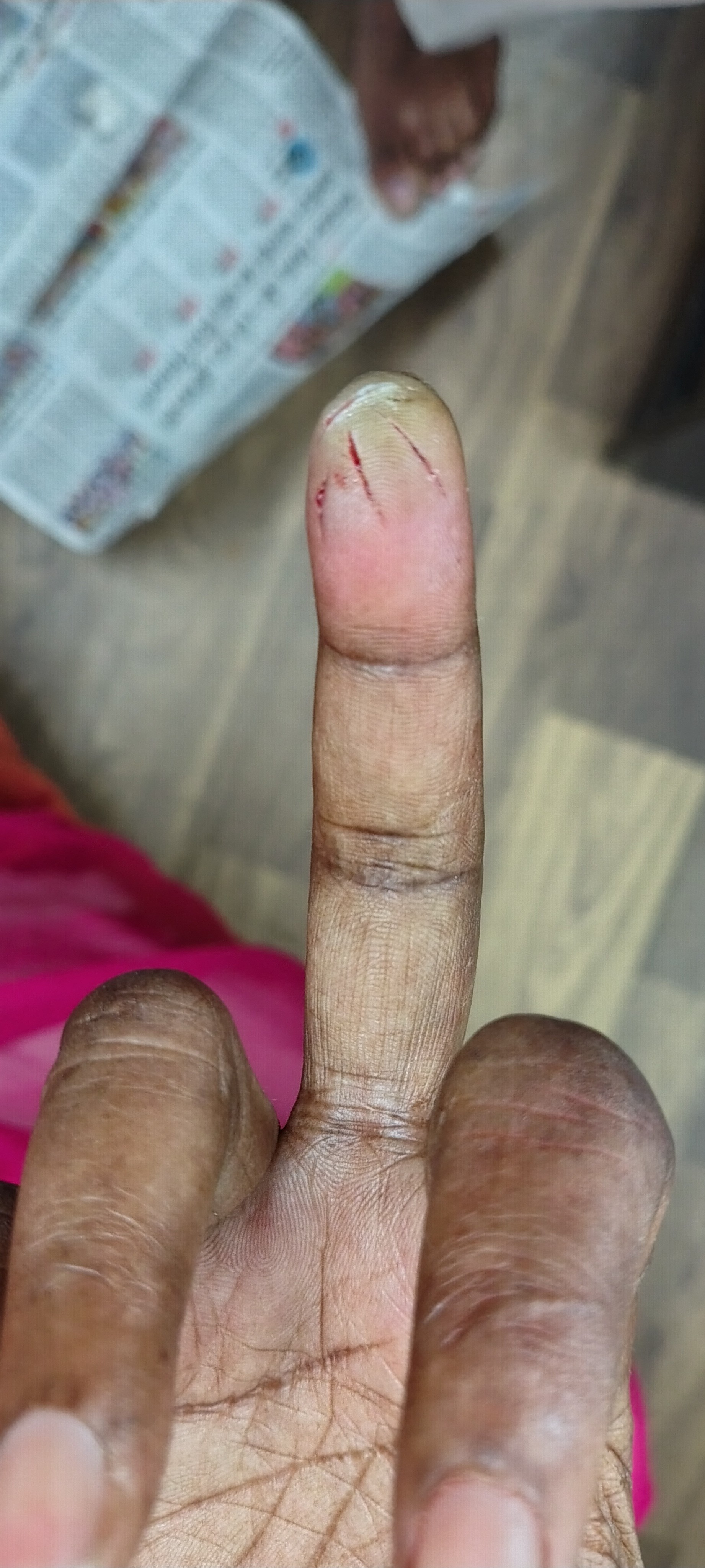 Devi After Treatment